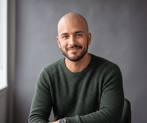 Portrait after bald head transformation showing realistic bald look