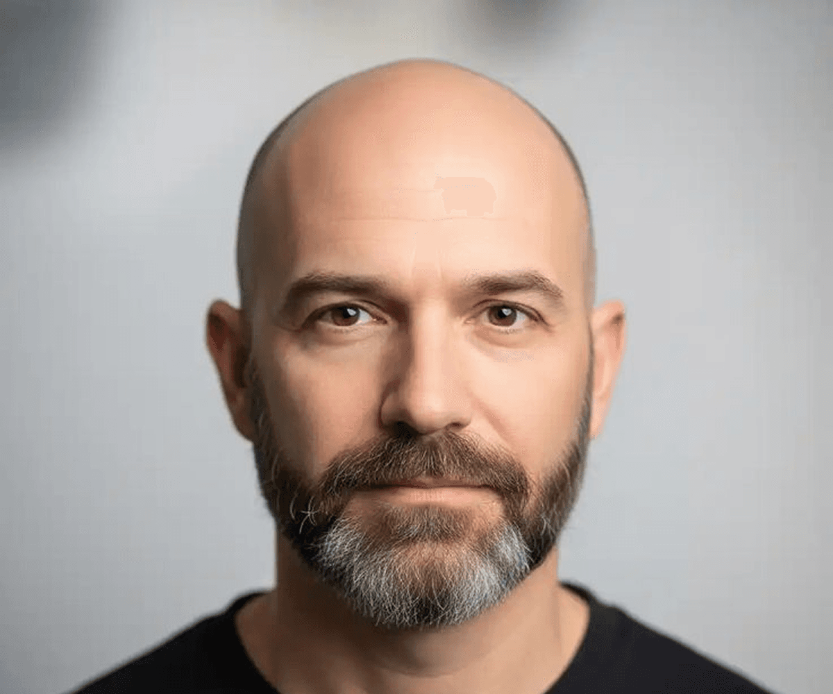Portrait after bald head transformation showing realistic bald look