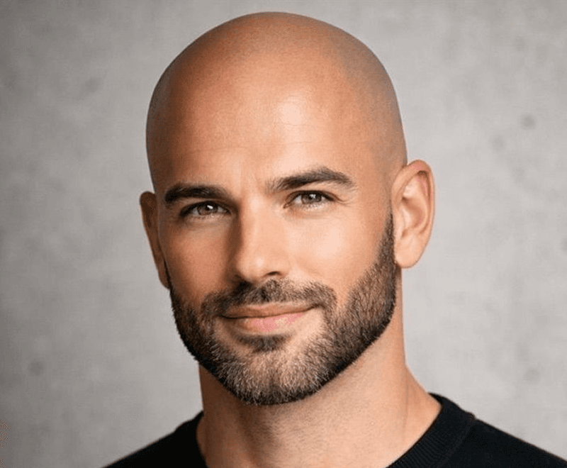 Portrait after AI bald filter showing realistic bald head transformation