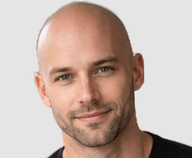 Portrait after AI head hair removal showing clean bald scalp